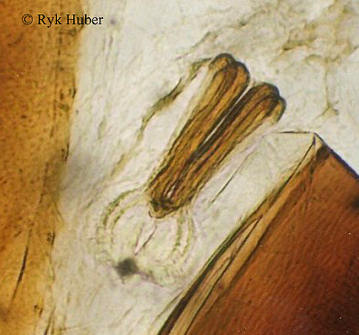 Proventrikulus-Lasius niger.jpg